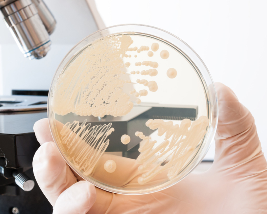 Analisi microbiologiche