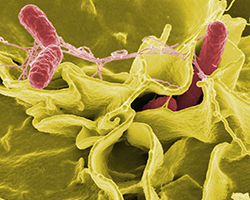 https://pixabay.com/es/photos/bacterias-salmonella-pat%C3%B3genos-67659/ 